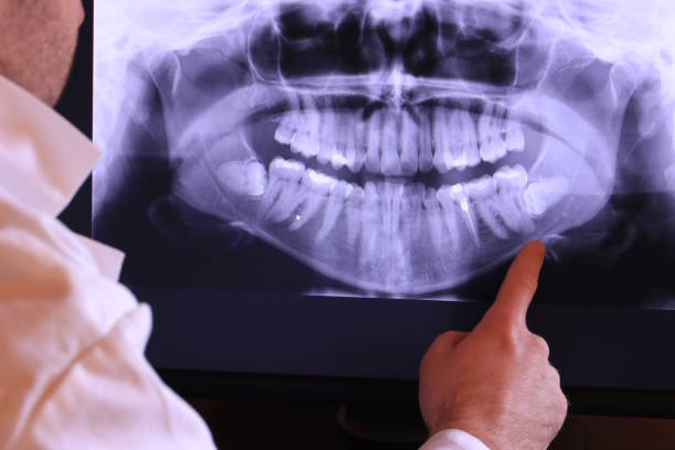 Best Orthodontic Emergency Dentist in Youngsville, NC