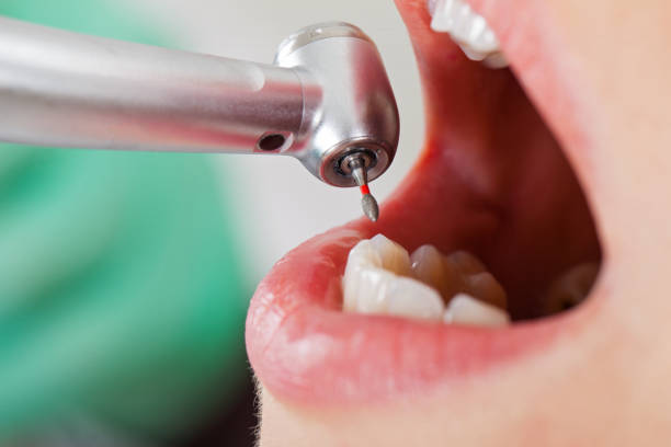 Best Broken or Cracked Tooth Emergency Dentist in Youngsville, NC